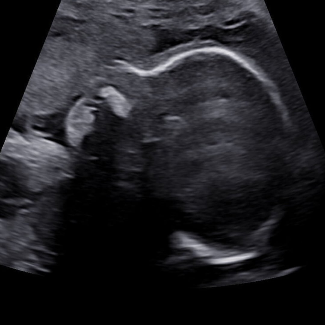 Photo shared by Natalie for their Babylist baby registry.