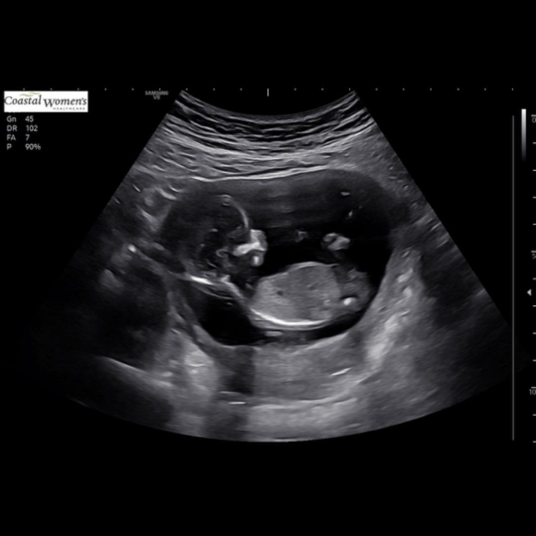 Photo shared by Alli for their Babylist baby registry.