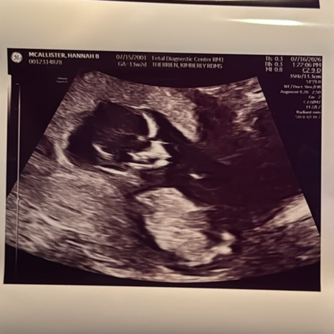 Photo shared by Hannah for their Babylist baby registry.