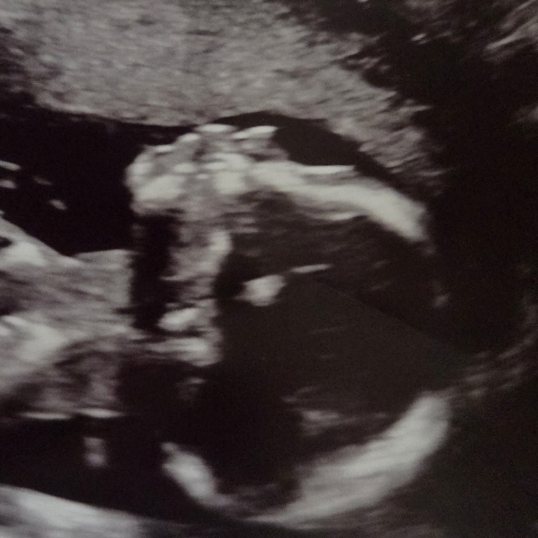 Photo shared by Tyla for their Babylist baby registry.
