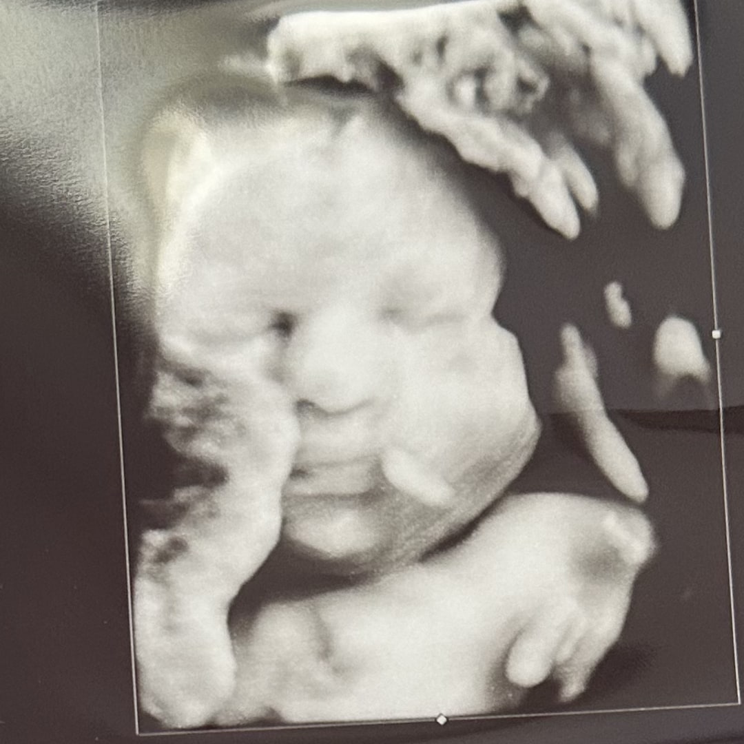 Photo shared by Giselle for their Babylist baby registry.