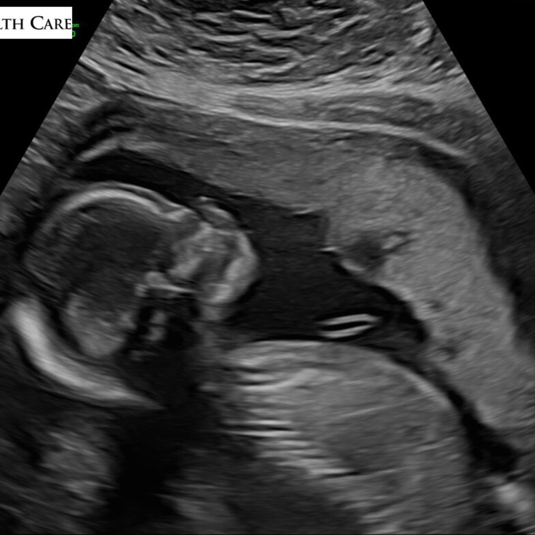 Photo shared by Danielle for their Babylist baby registry.