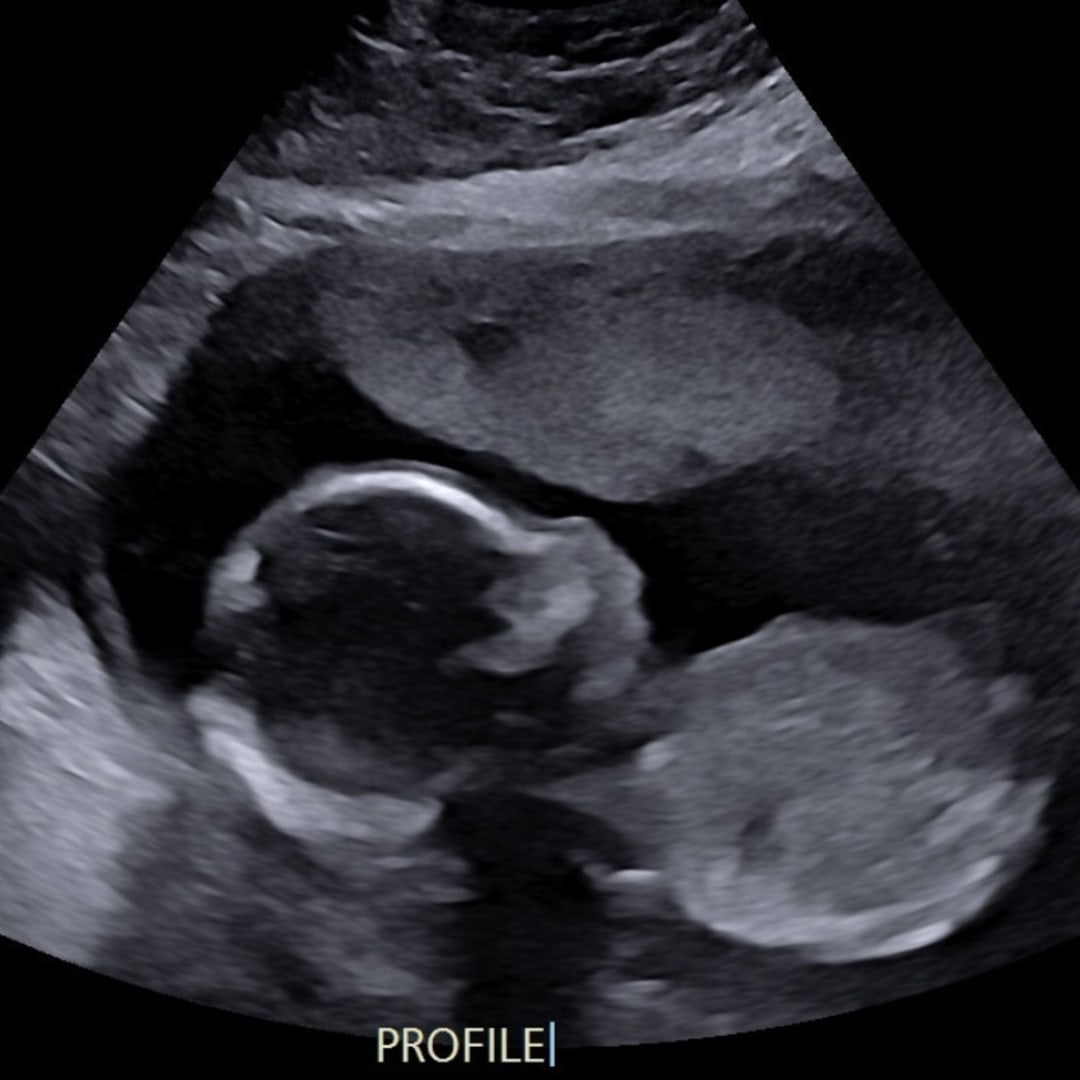 Photo shared by Jolie for their Babylist baby registry.