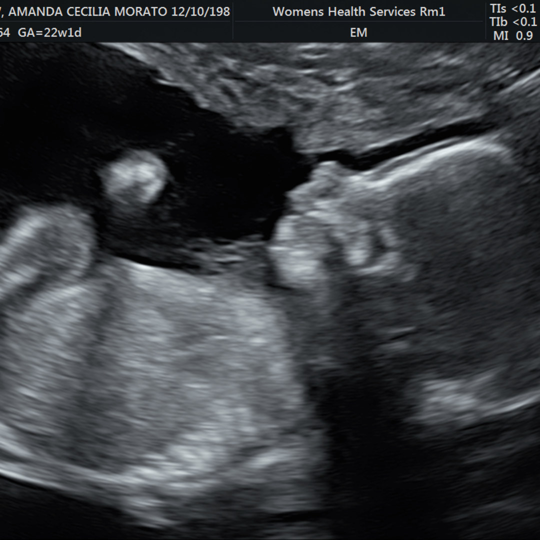 Photo shared by Amanda for their Babylist baby registry.