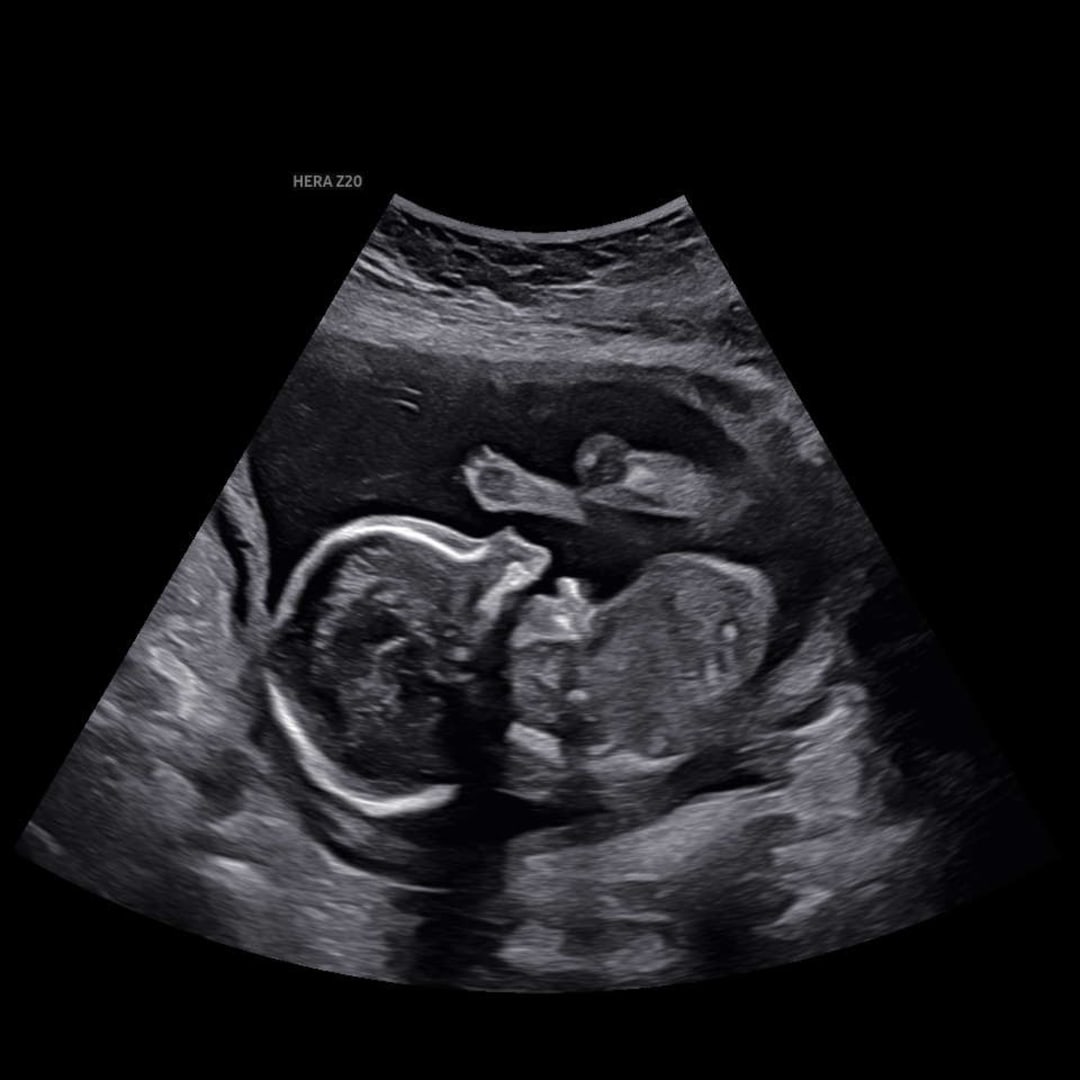 Photo shared by Alison for their Babylist baby registry.