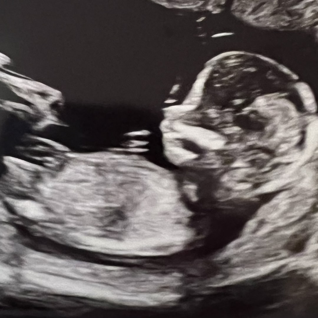 Photo shared by Bethany for their Babylist baby registry.