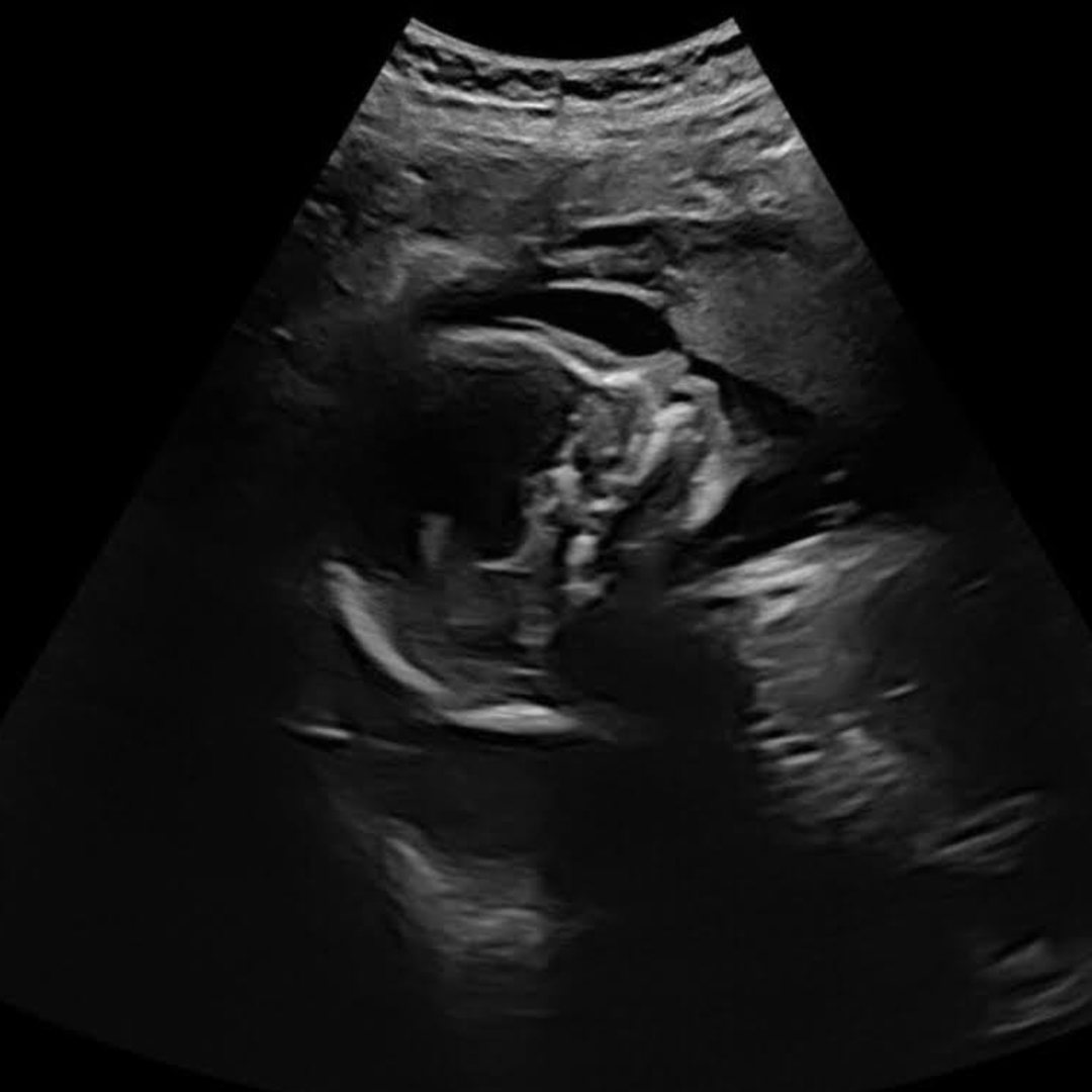 Photo shared by Autum for their Babylist baby registry.