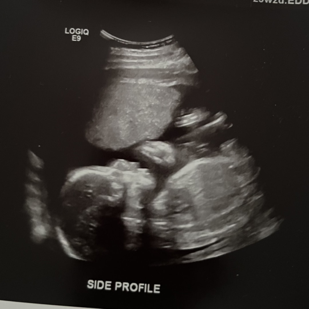 Photo shared by Rachael for their Babylist baby registry.