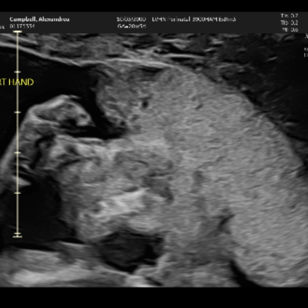 Photo shared by Ally for their Babylist baby registry.