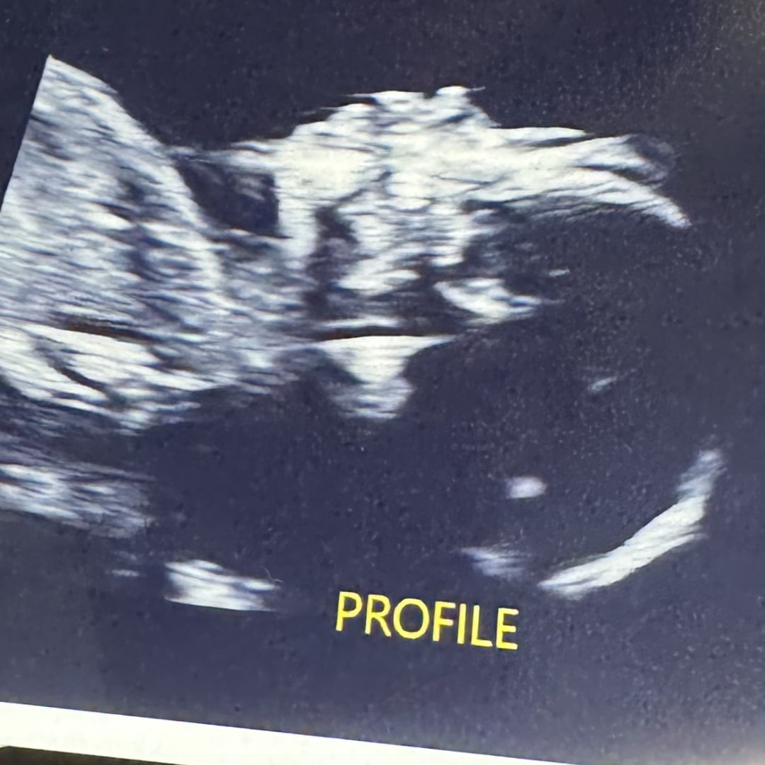 Photo shared by Jena for their Babylist baby registry.