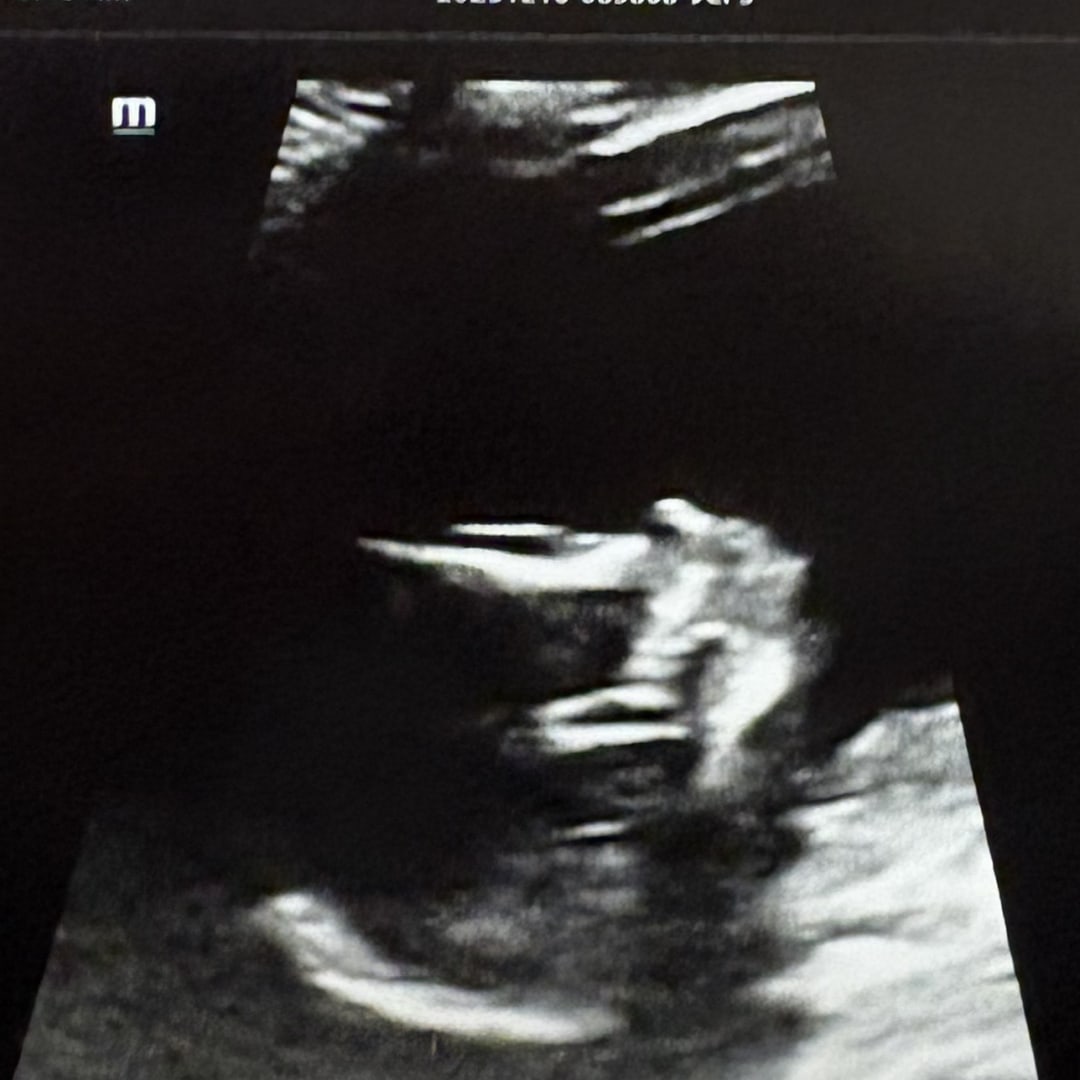 Photo shared by Mia for their Babylist baby registry.