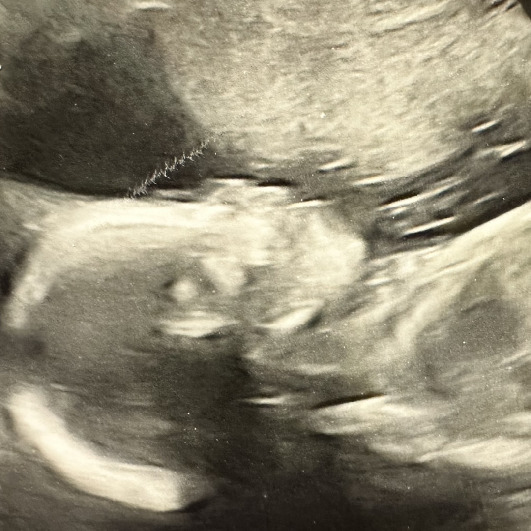 Photo shared by Pamela for their Babylist baby registry.