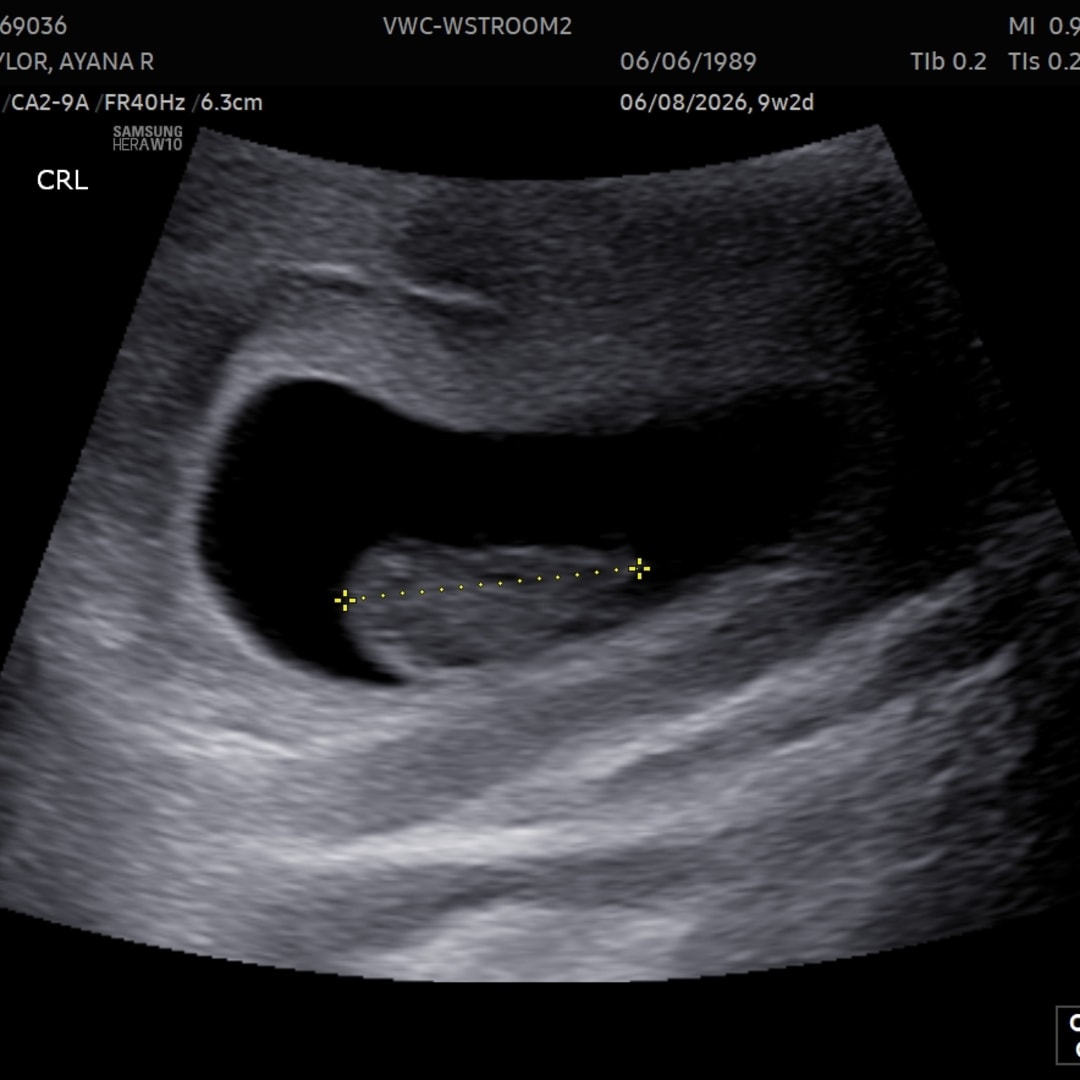 Photo shared by Ayana for their Babylist baby registry.