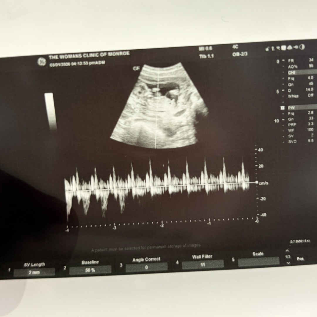Photo shared by Seaira for their Babylist baby registry.