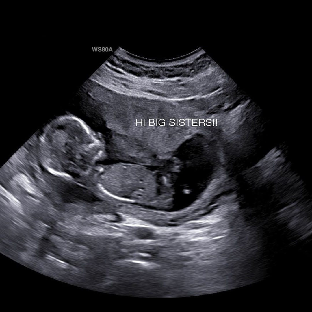 Photo shared by Brook for their Babylist baby registry.