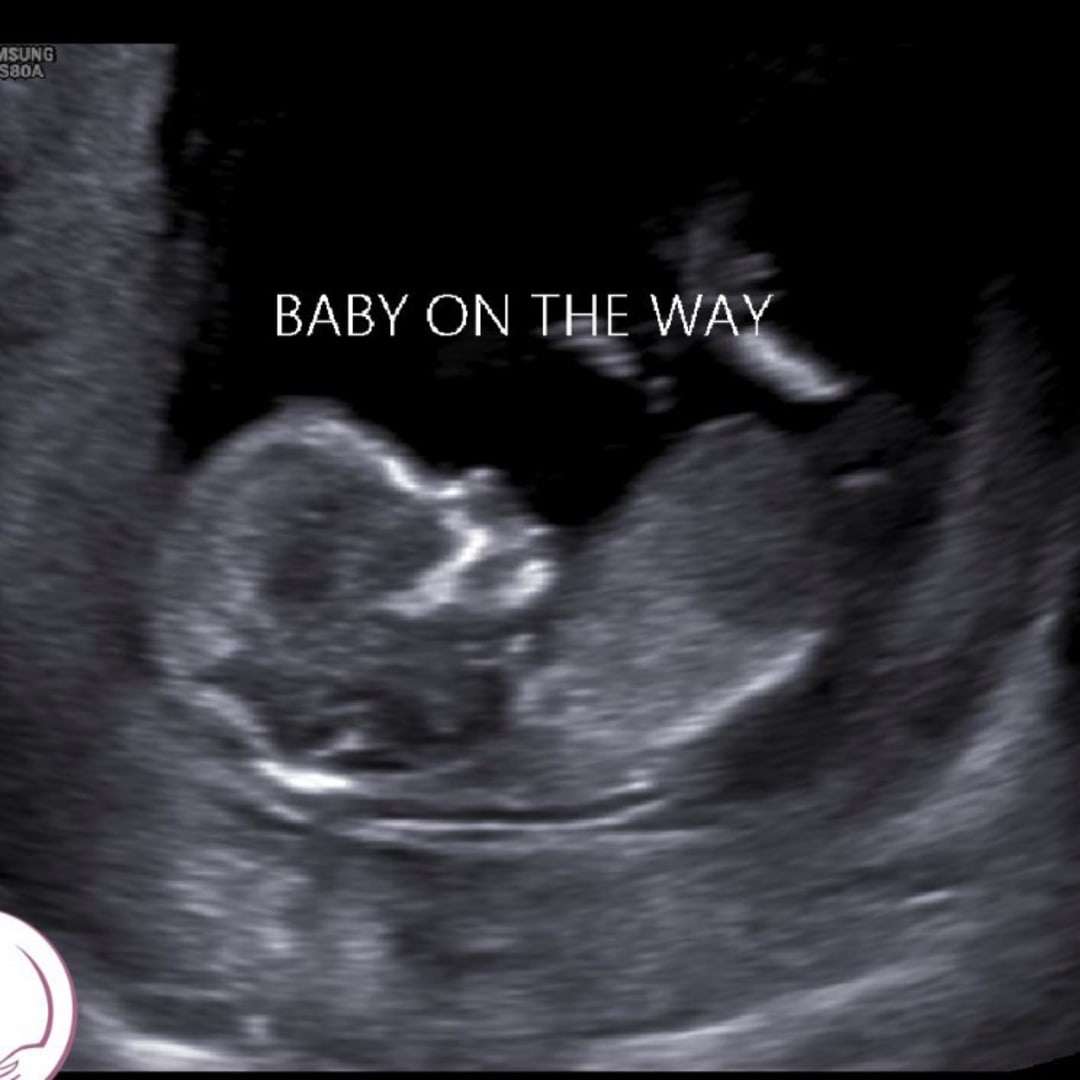 Photo shared by Paulina for their Babylist baby registry.
