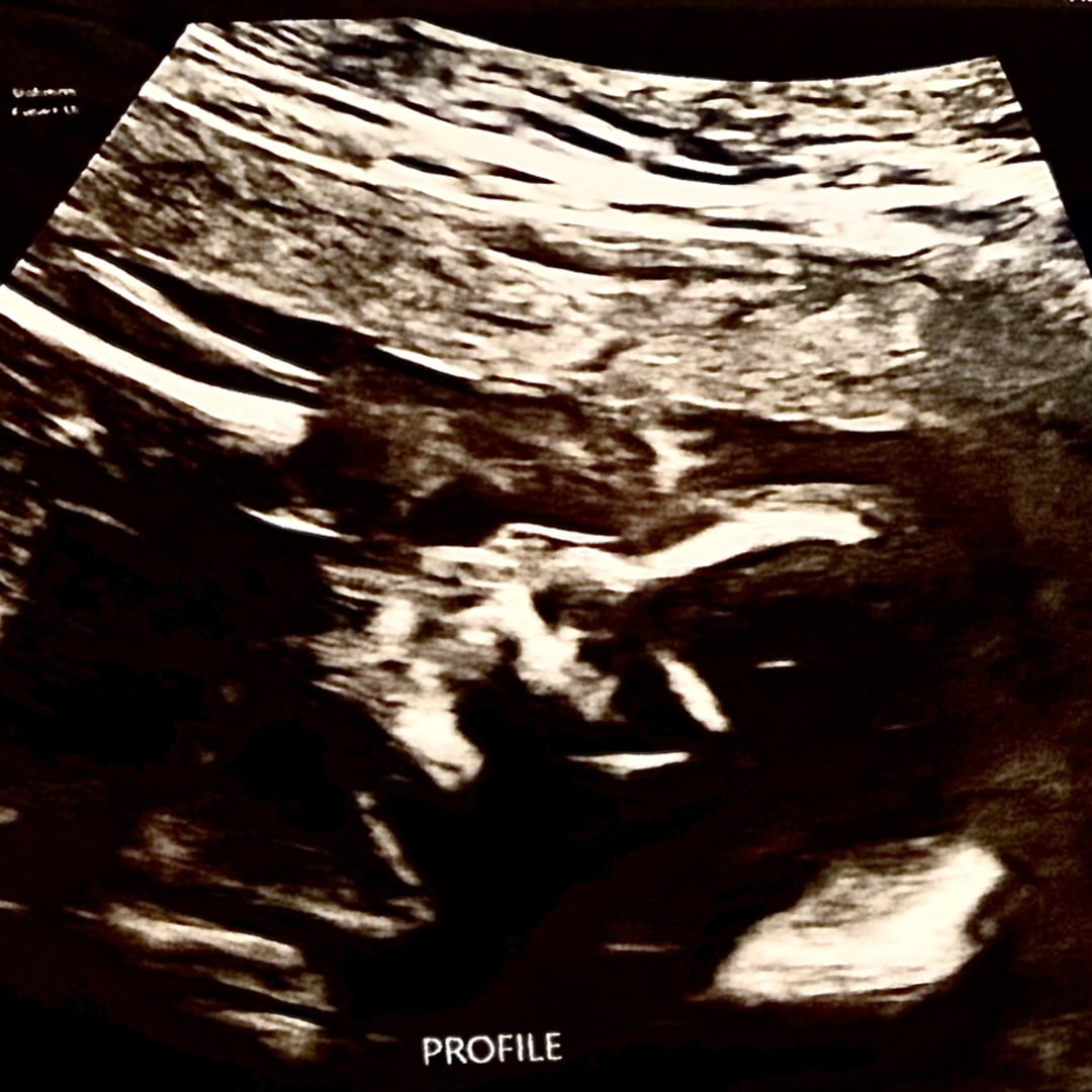 Photo shared by Lindsey for their Babylist baby registry.
