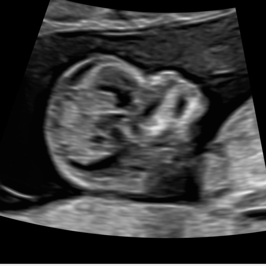 Photo shared by Melani for their Babylist baby registry.