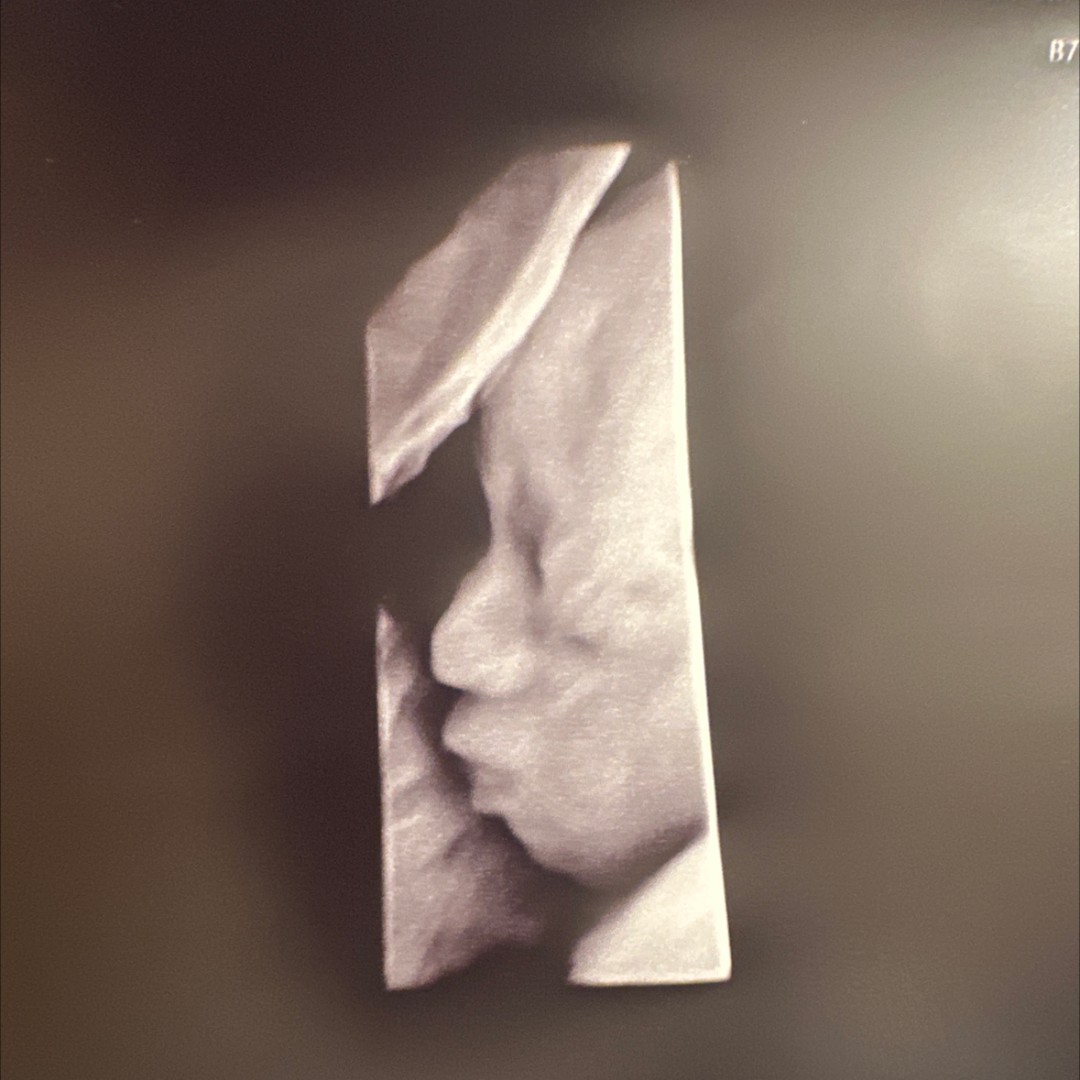 Photo shared by Imari for their Babylist baby registry.