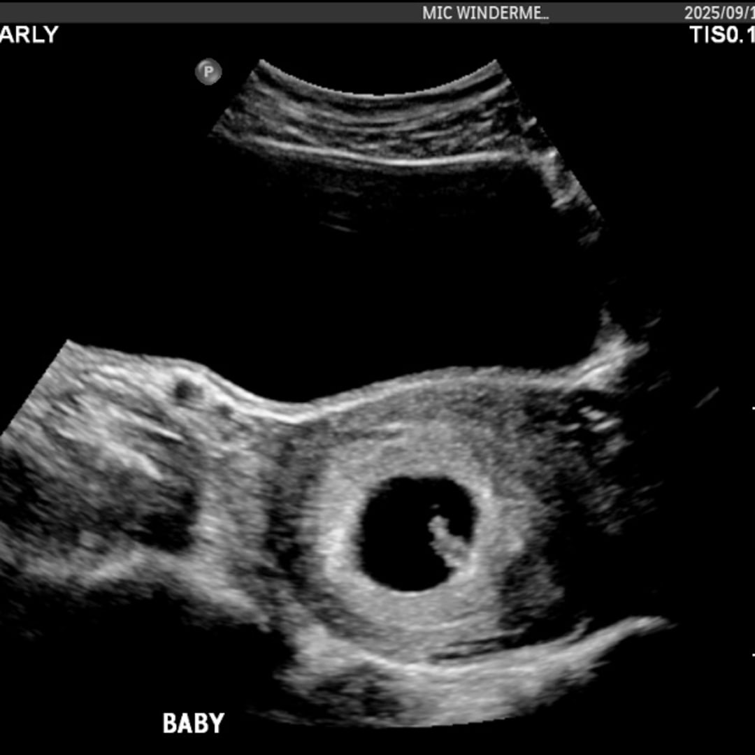 Photo shared by Sara for their Babylist baby registry.