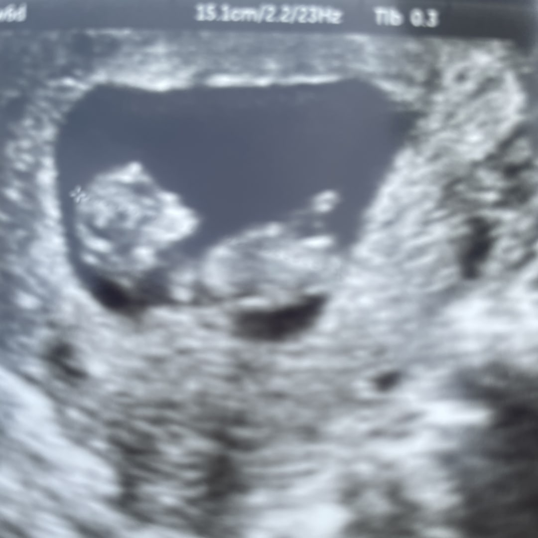Photo shared by Bailey for their Babylist baby registry.