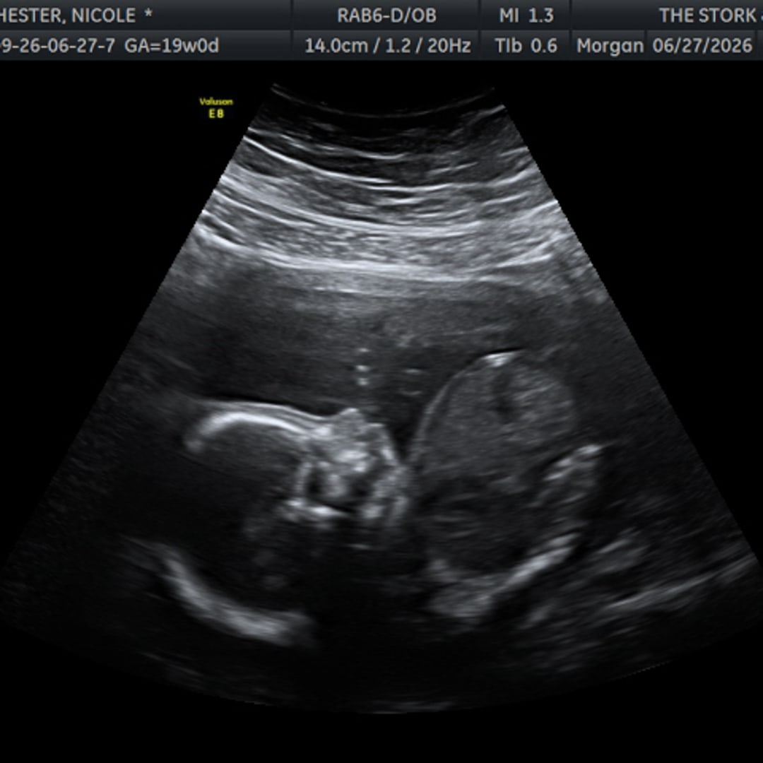 Photo shared by Nicole for their Babylist baby registry.