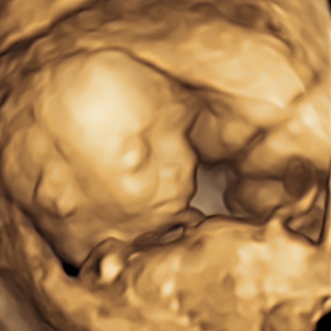 Photo shared by Ada for their Babylist baby registry.