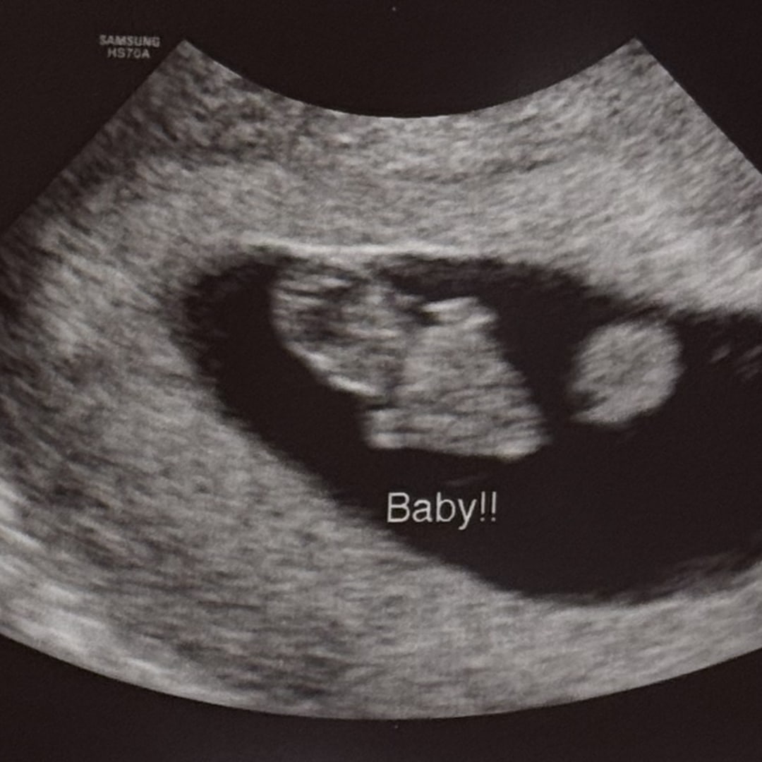 Photo shared by Brittney for their Babylist baby registry.
