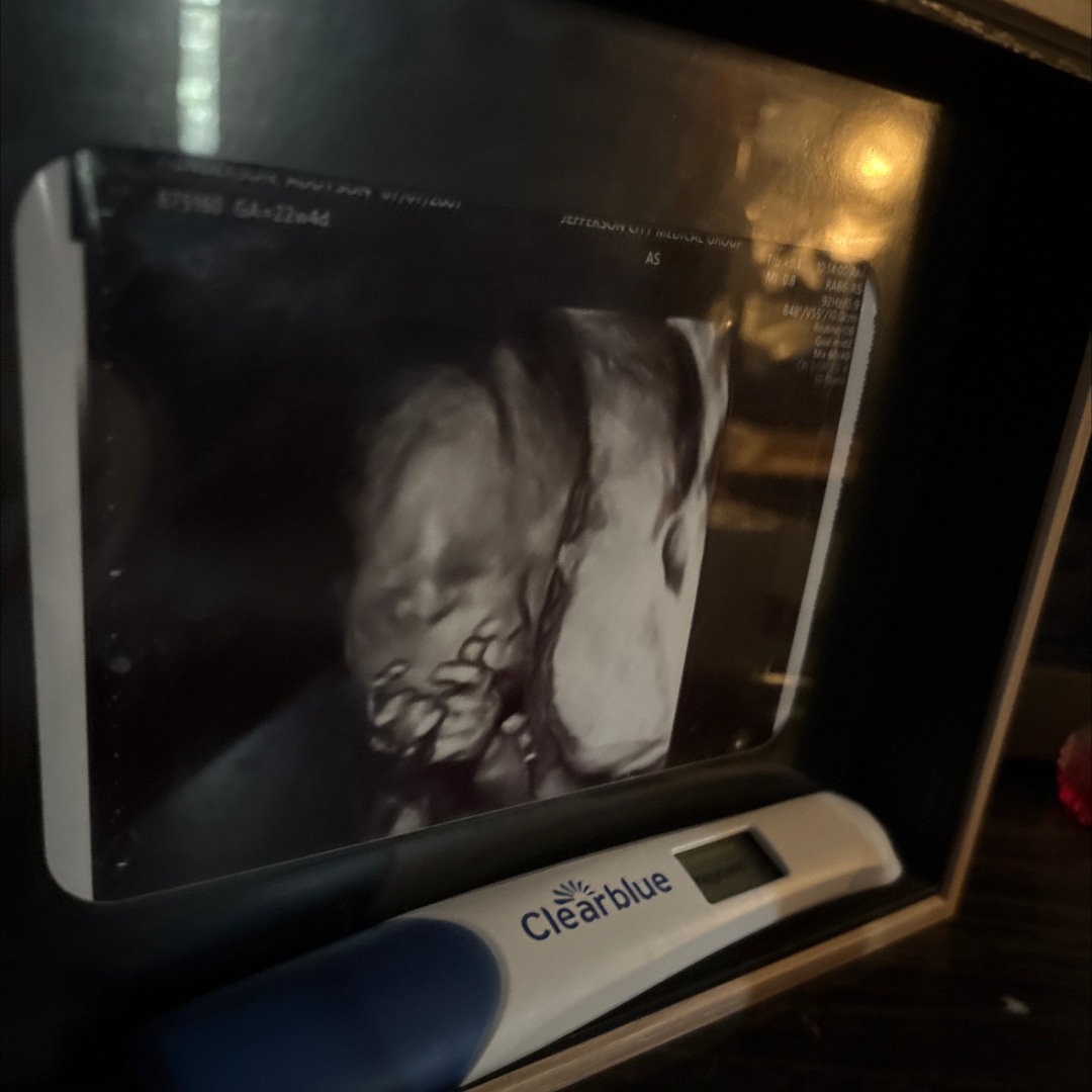 Photo shared by Addyson for their Babylist baby registry.
