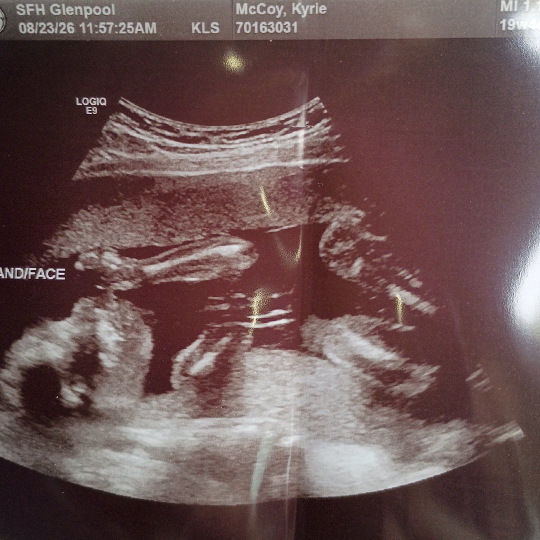 Photo shared by Kyrie for their Babylist baby registry.