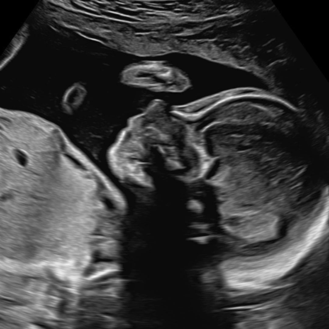 Photo shared by Bre for their Babylist baby registry.