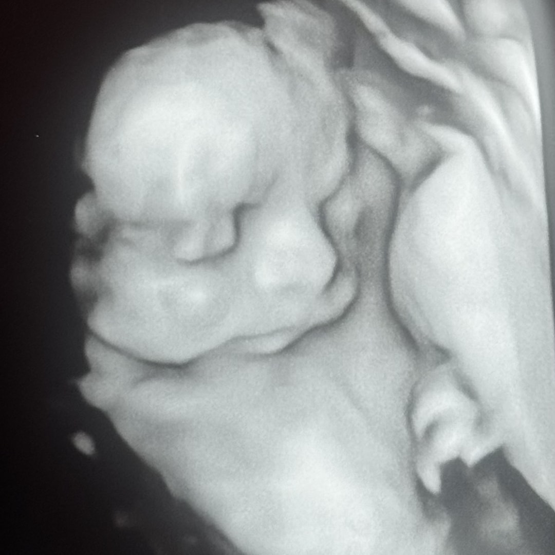 Photo shared by Savanna for their Babylist baby registry.