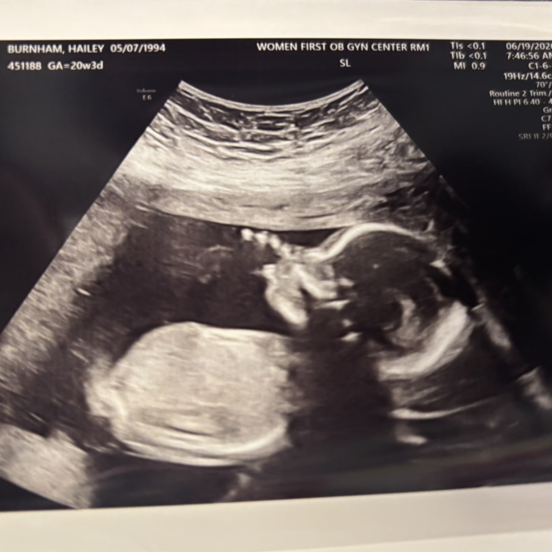 Photo shared by Hailey for their Babylist baby registry.
