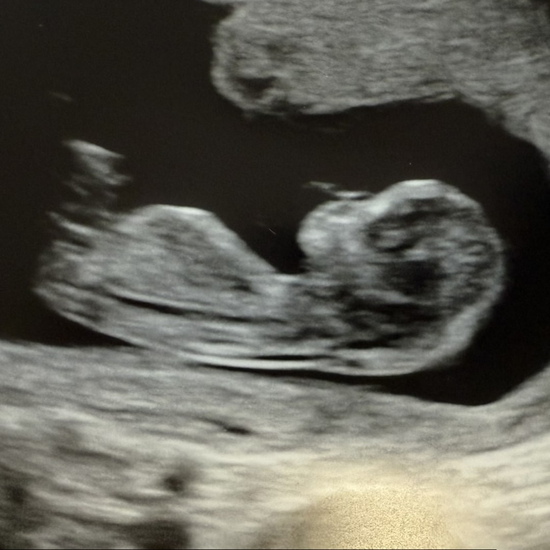 Photo shared by Ashley for their Babylist baby registry.