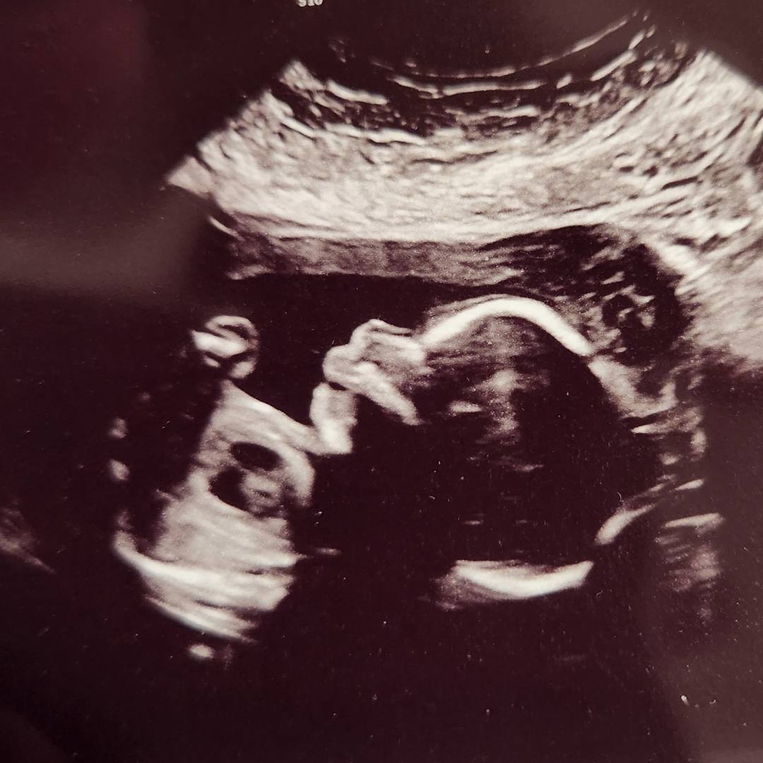 Photo shared by Allie for their Babylist baby registry.