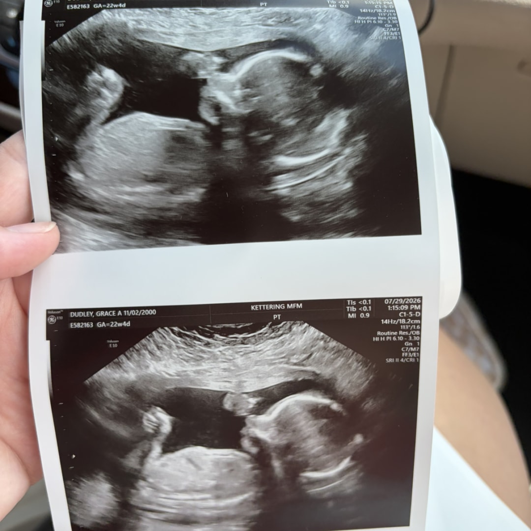 Photo shared by Grace for their Babylist baby registry.
