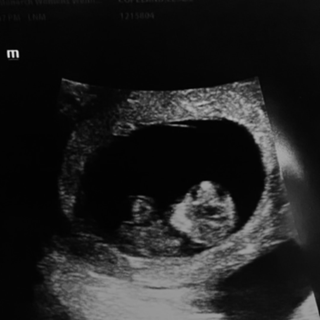 Photo shared by Gabe & Leslie for their Babylist baby registry.