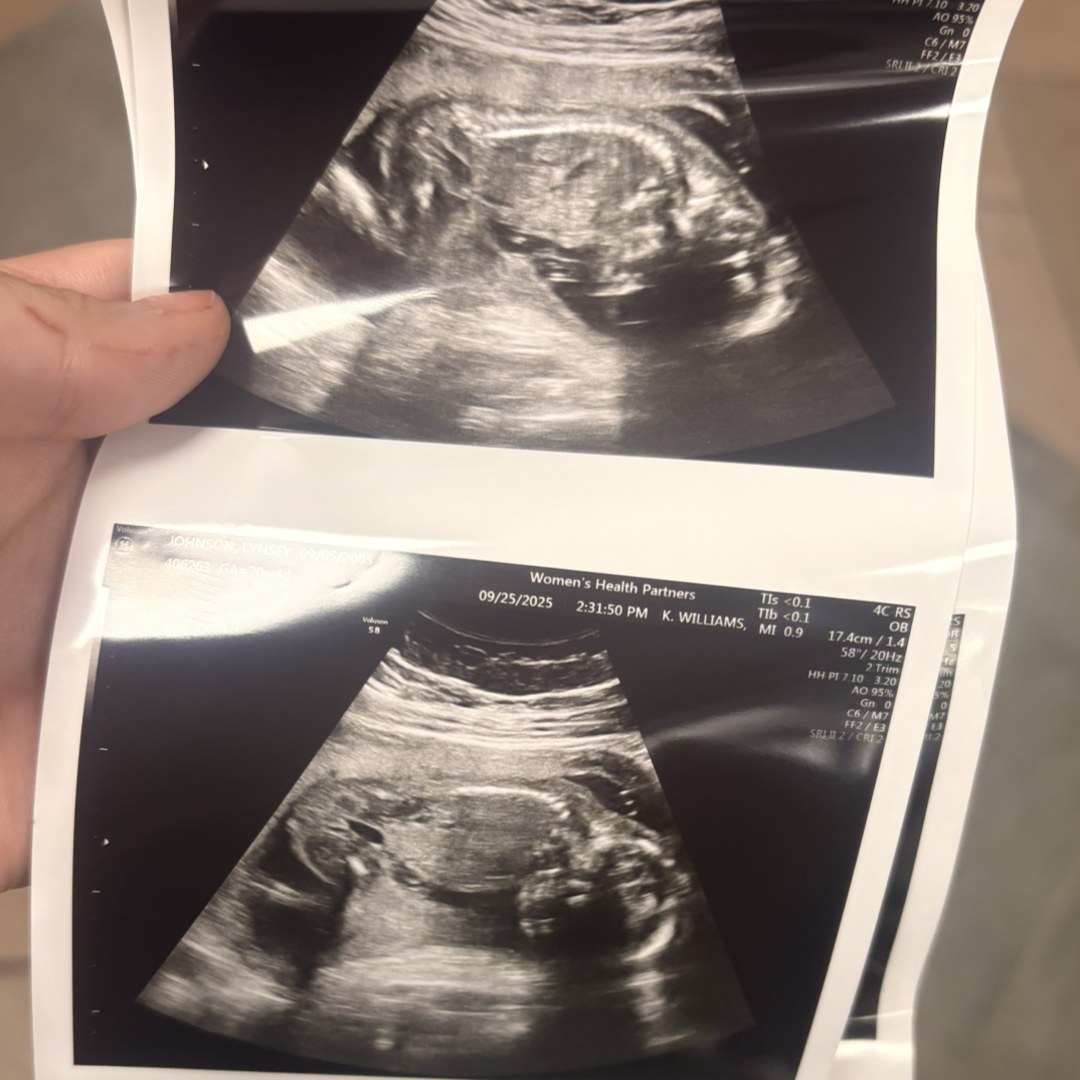 Photo shared by Lynsey for their Babylist baby registry.