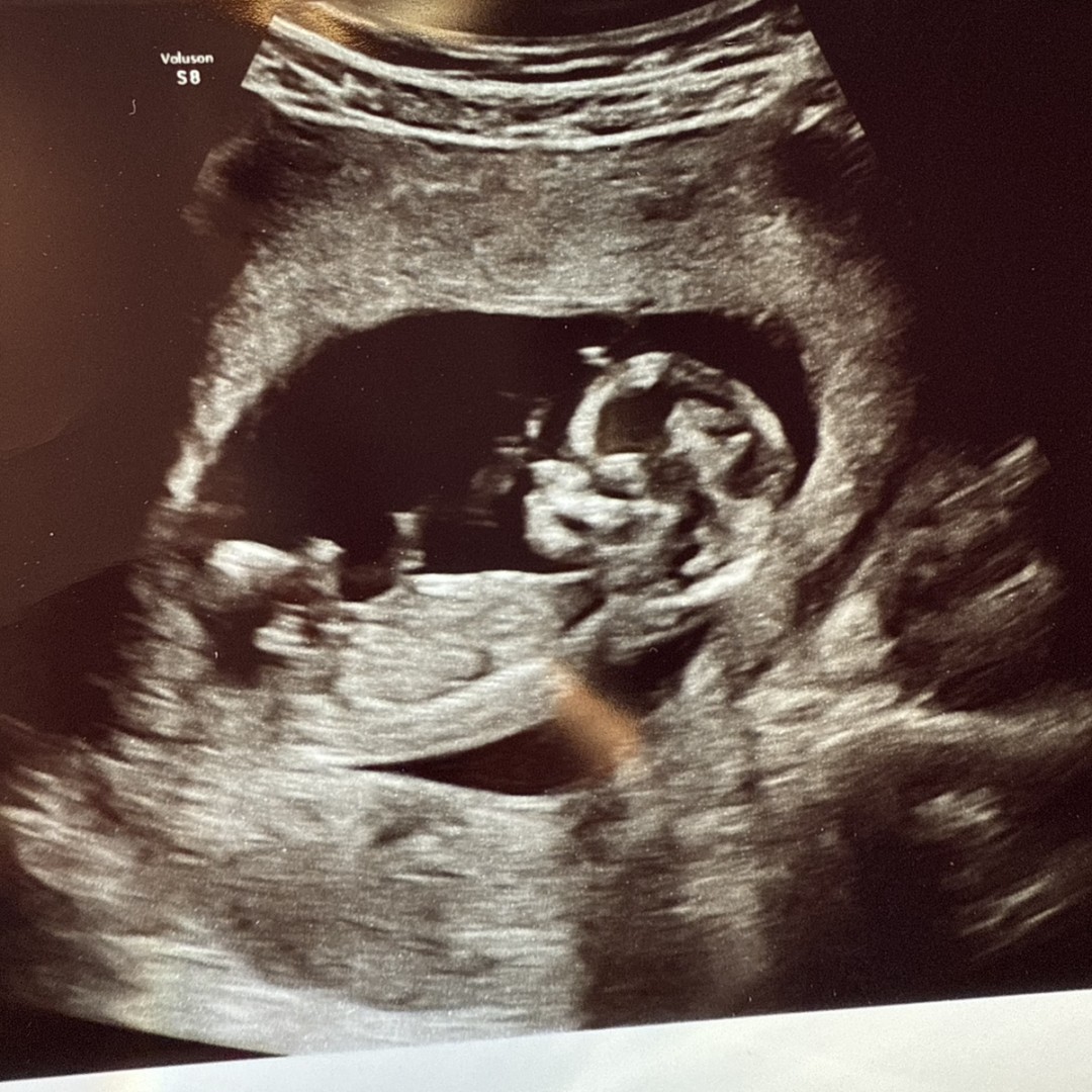 Photo shared by Cami for their Babylist baby registry.