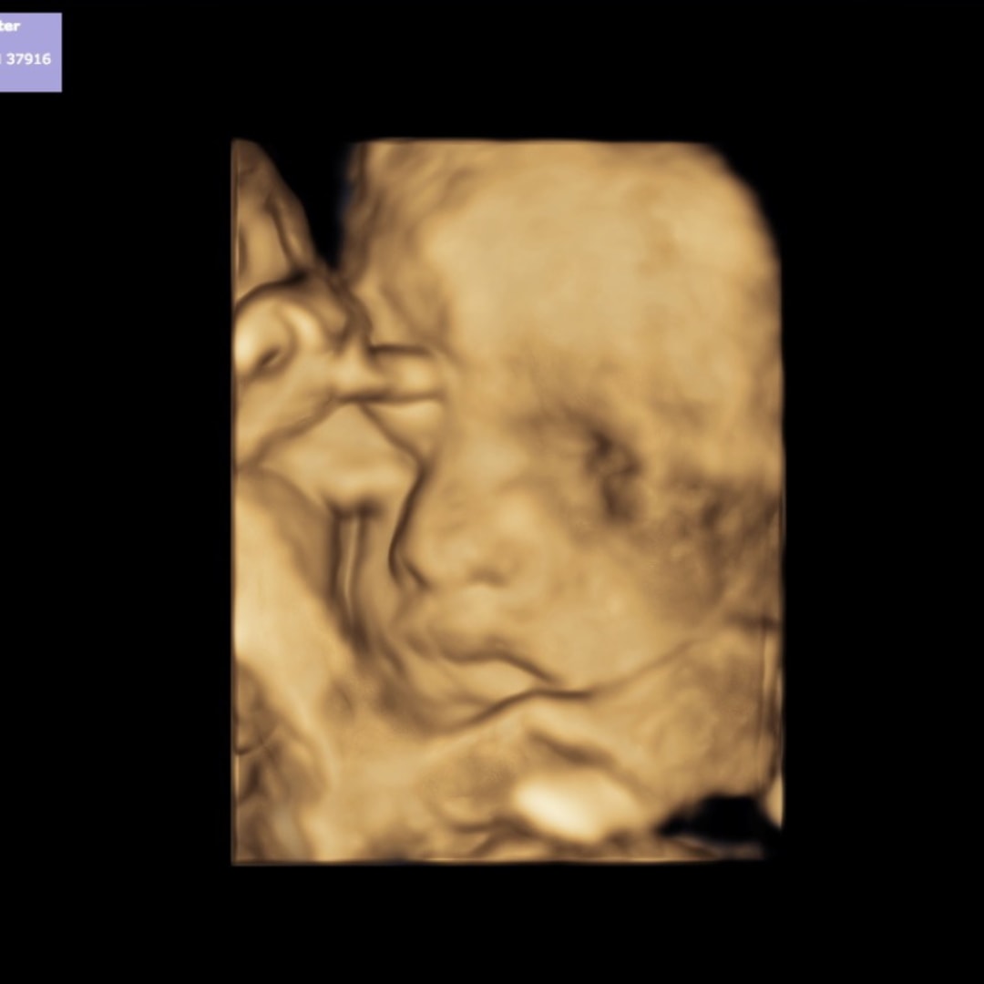 Photo shared by Briana for their Babylist baby registry.