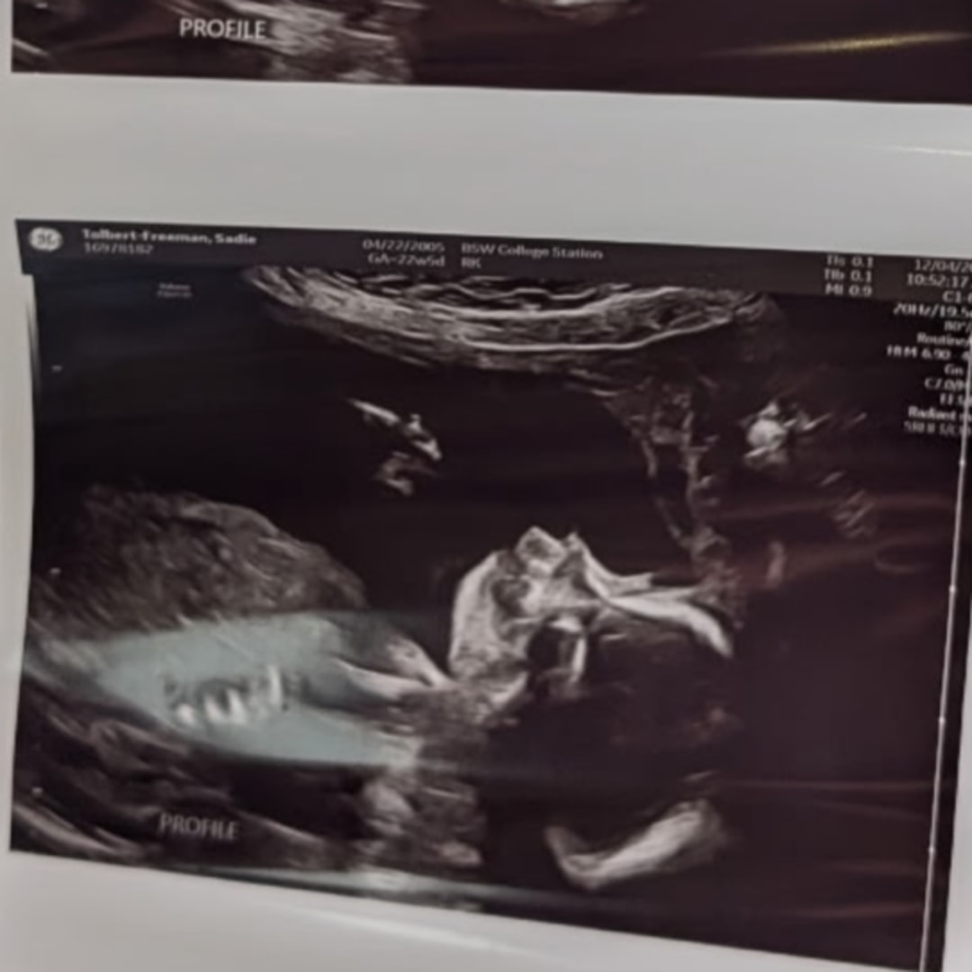 Photo shared by Sadie for their Babylist baby registry.