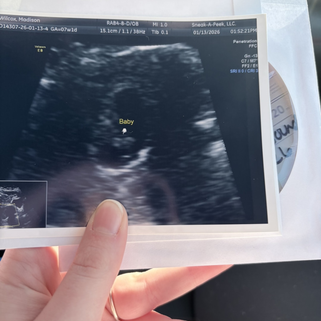 Photo shared by Madison for their Babylist baby registry.