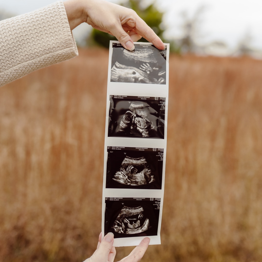 Photo shared by Isa for their Babylist baby registry.