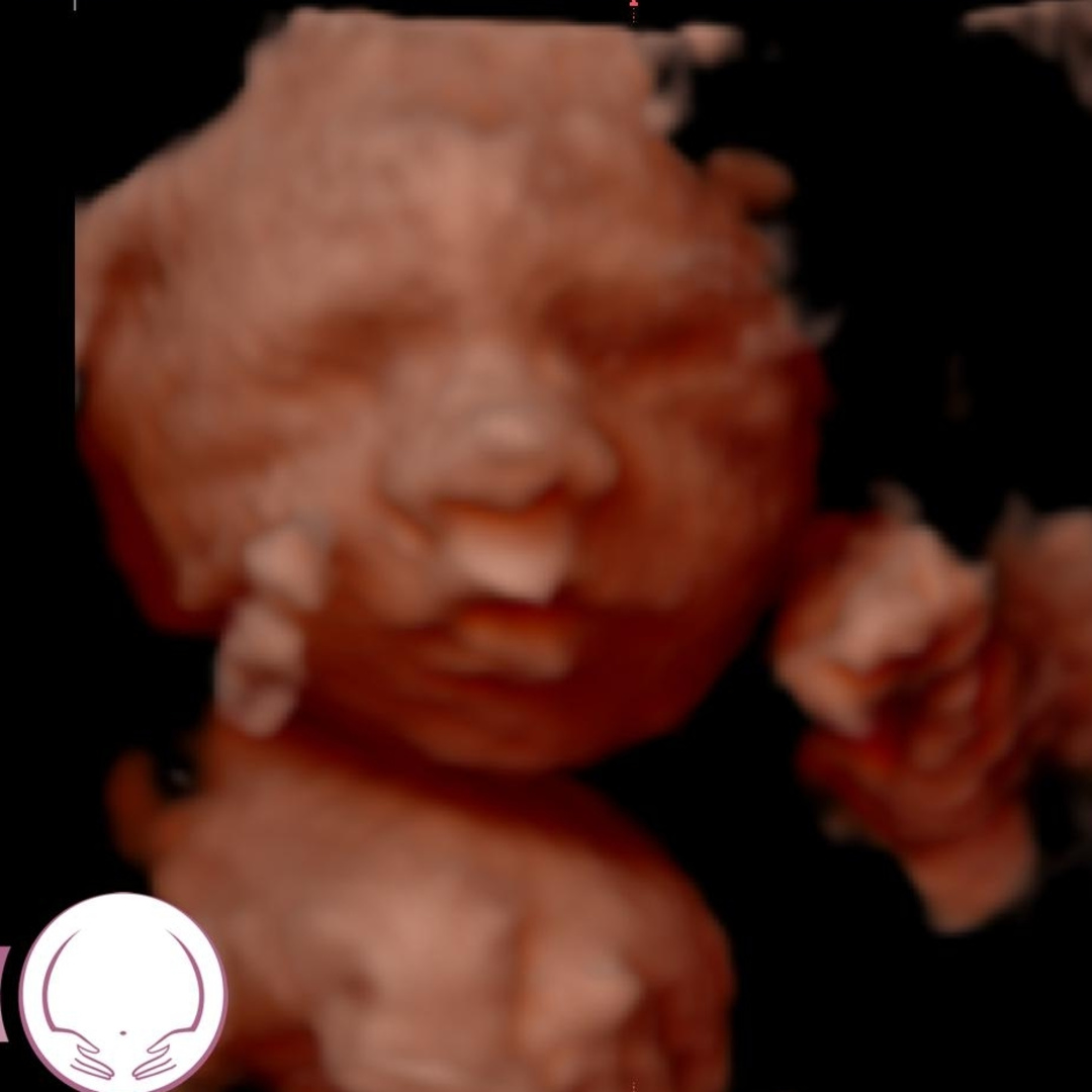 Photo shared by Valerie for their Babylist baby registry.