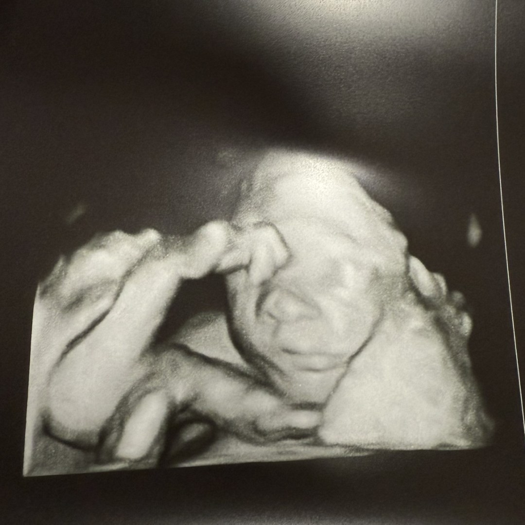 Photo shared by Mackenzie for their Babylist baby registry.
