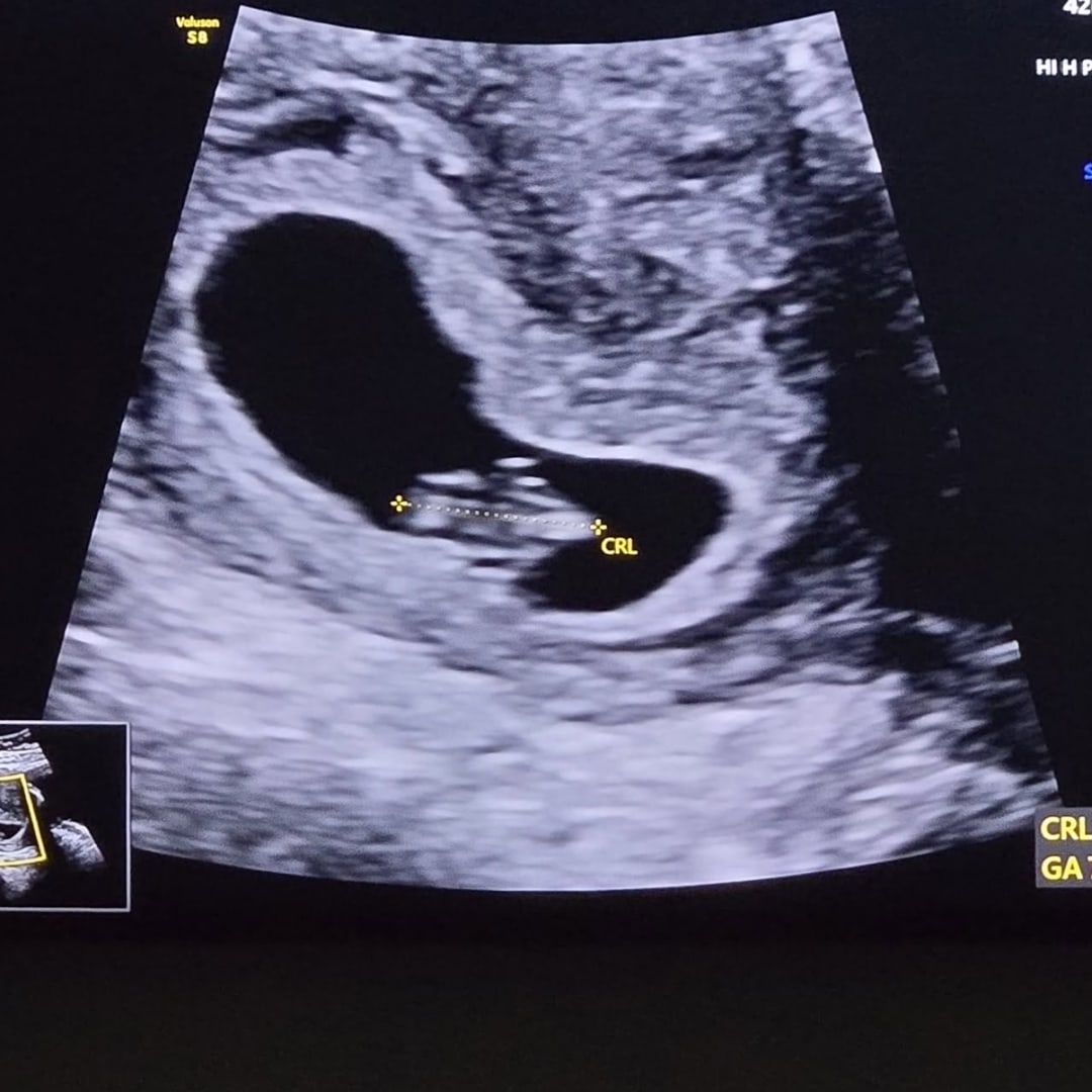 Photo shared by Karissa for their Babylist baby registry.