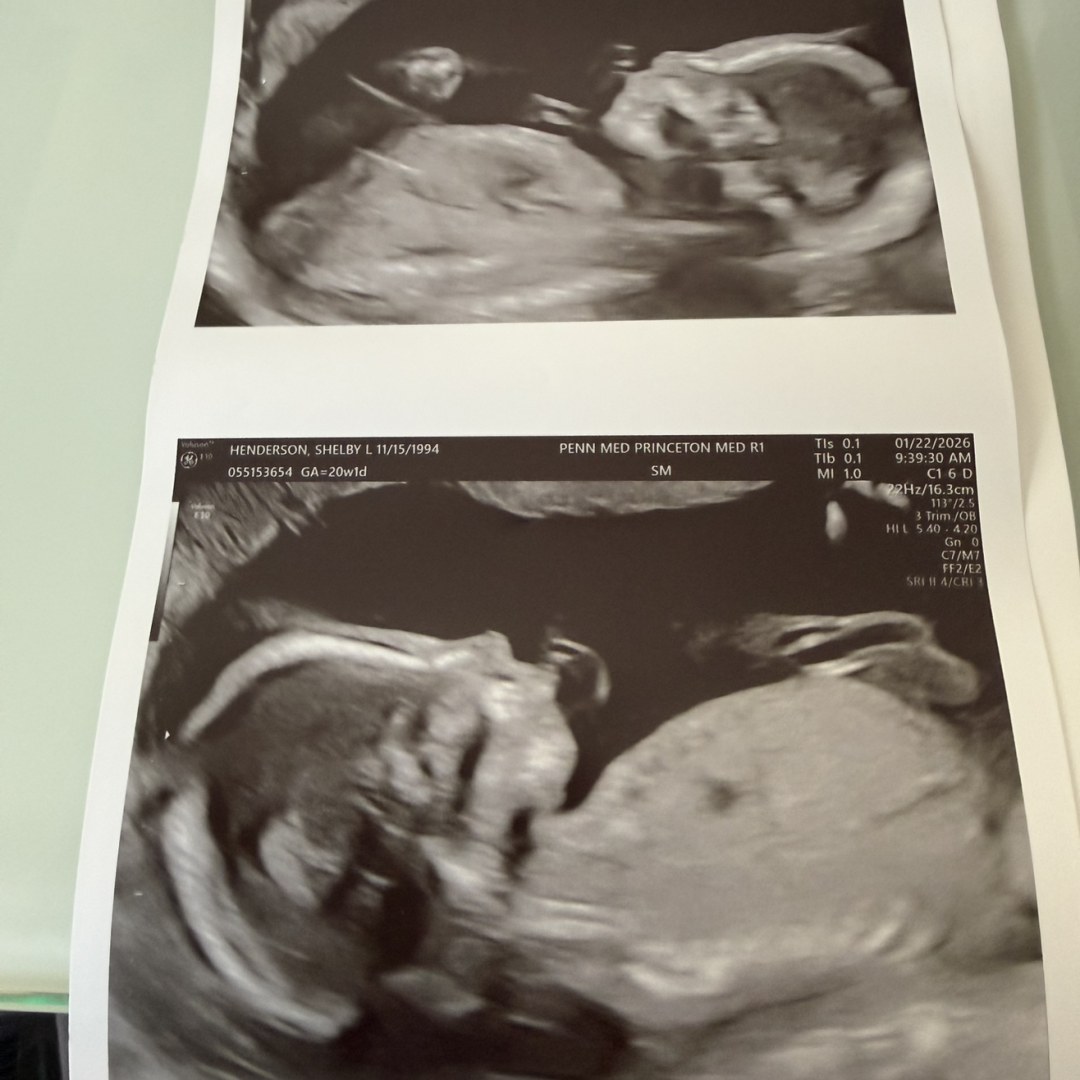 Photo shared by Shelby for their Babylist baby registry.