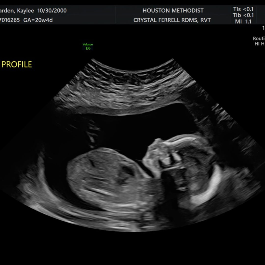 Photo shared by Kaylee for their Babylist baby registry.