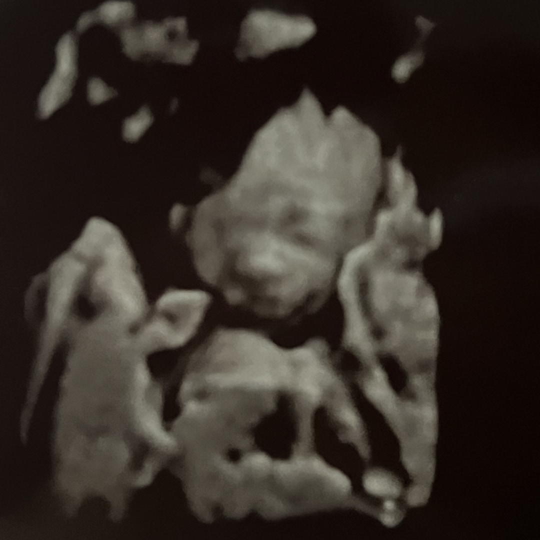 Photo shared by Aleighsha for their Babylist baby registry.