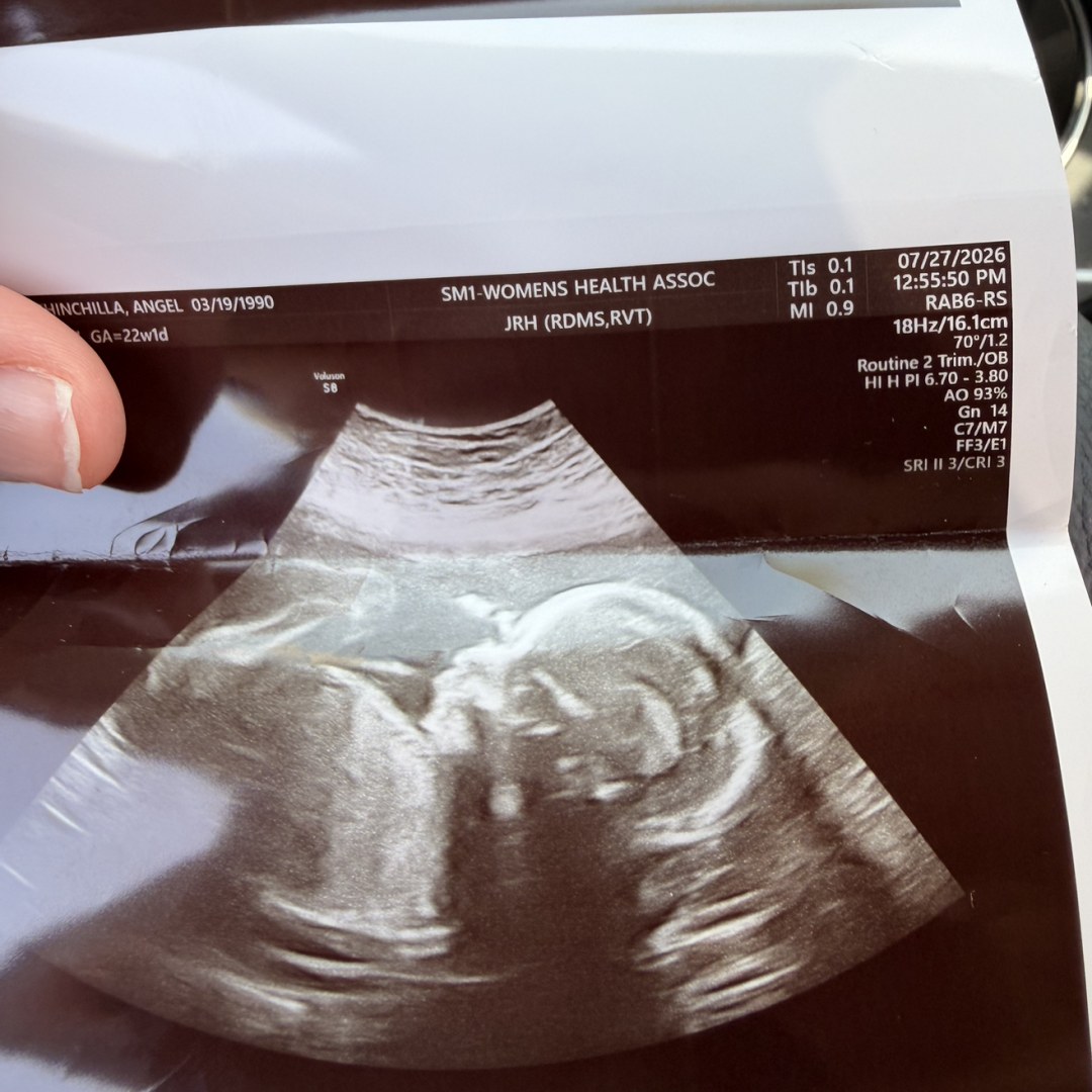 Photo shared by ANGEL for their Babylist baby registry.